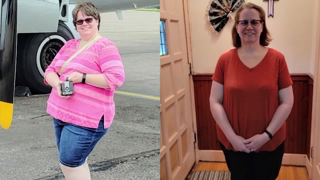 Couple Achieves Significant Weight Loss Without Surgery Sanford