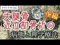 大腿骨近位部骨折の病態と理学療法　後編