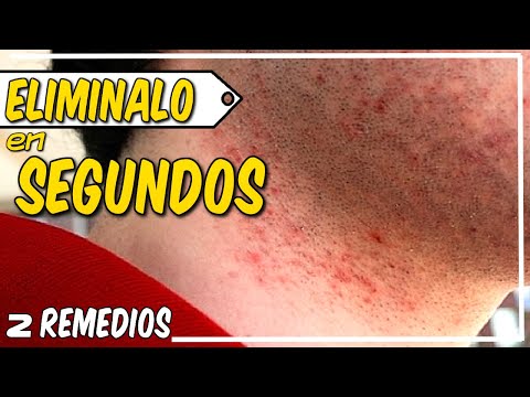 Video: Los 11 Mejores Aceites Para Antes Del Afeitado Para Prevenir La Irritación De La Piel Y Las Quemaduras Por Afeitado