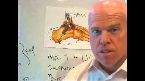 Permanent Impairment due to "Ankle Instability" -  www.ezqmeceu.com Perry J. Carpenter DC QME