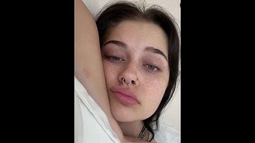 The beauty of freckles ✨ #shorts #freckles #insecurities #aesthetic