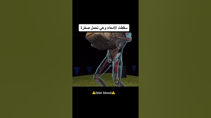أبشجع الطرق التي توفي بها الناس😔