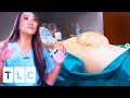 “Get This Off My Back!” The Biggest Back Lumps | Dr. Pimple Popper