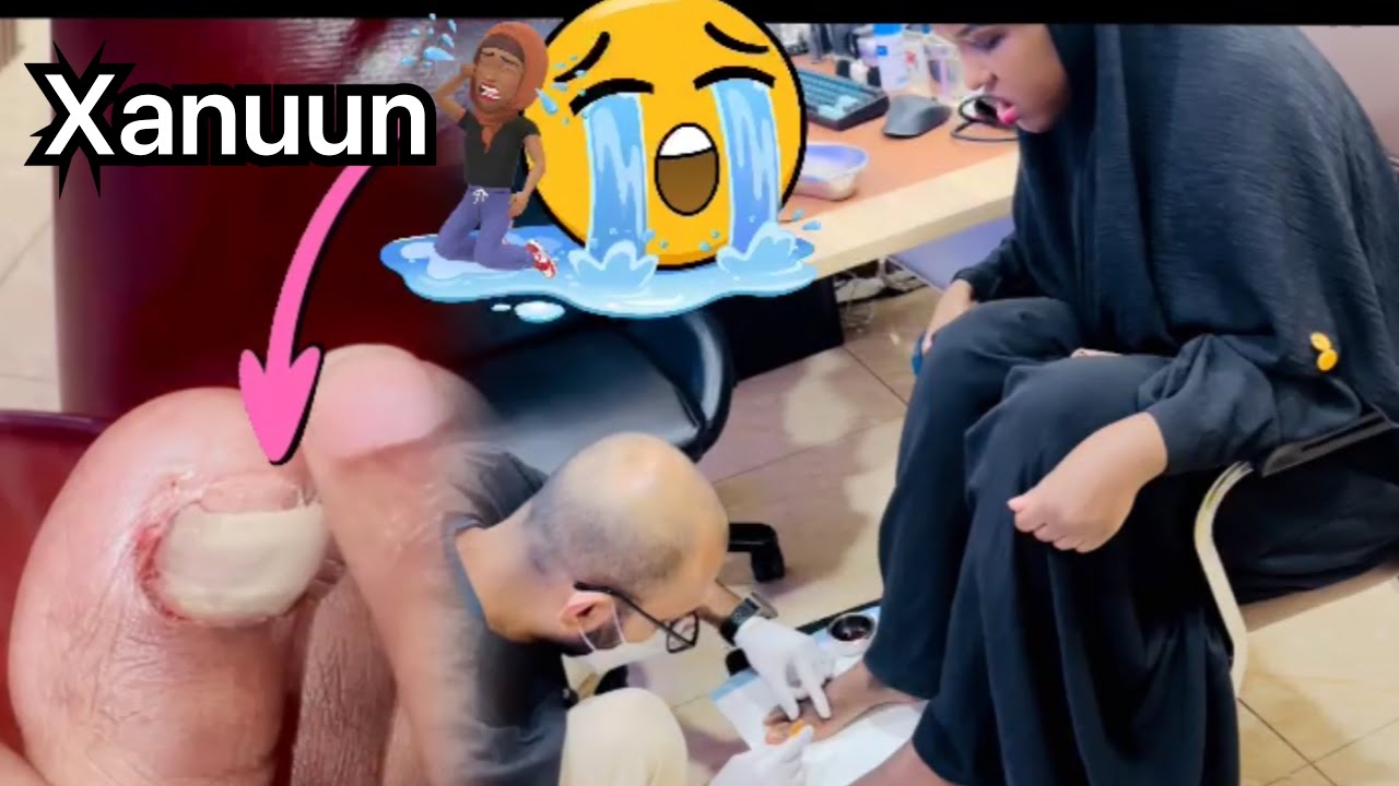 XANUUN BADAN KADIB WAA LASOOWADA SAARAY ALXAMDULILAH