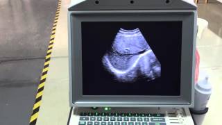 Zoncare-HCU I50 Zoncare-HCU I50