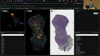 CBIAS 2023 - Tong Li - WebAtlas pipeline for integrated single cell and spatial transcriptomic data