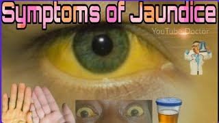 Jaundice symptoms | English| By Youtube Doctor| Diagnose yourself