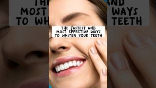 The fastest and most effective ways to whiten your teeth #shorts #teethwhitening #teeth