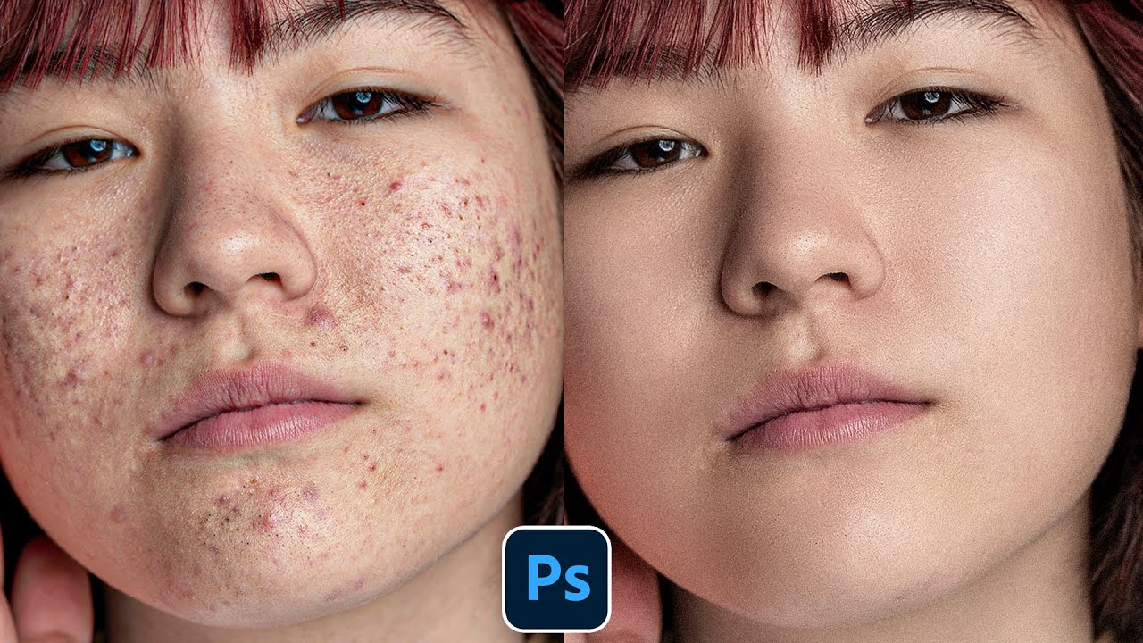 Face Retouching – Best Photoshop Tutorial | Skin Retouching 2023