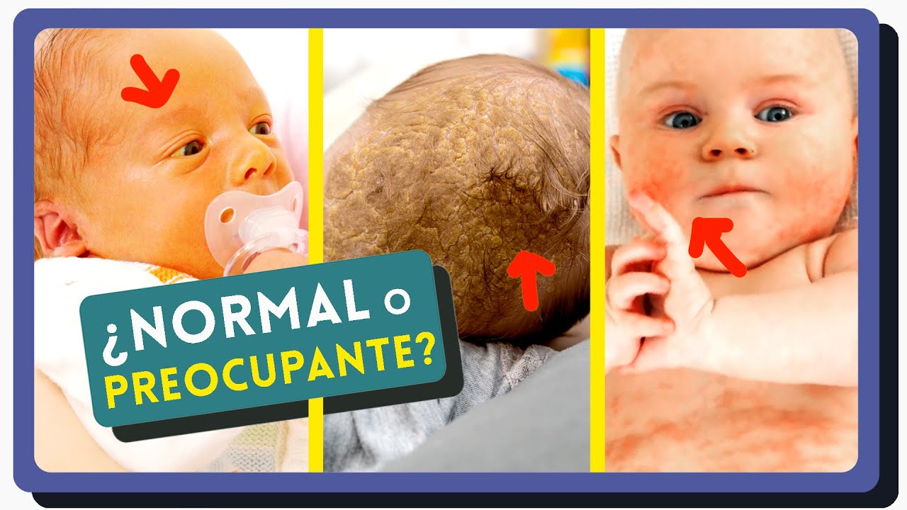 Sudor frío en bebés: Causas y qué hacer al respecto – Médica El Marqués, image size:1280x720