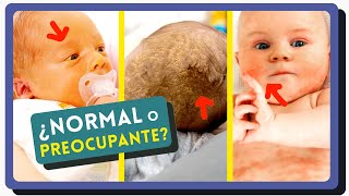 EVERYTHING YOU NEED TO KNOW ABOUT BABY SKIN: Jaundice, Sun Protection, Newborns, Atopy... EVERYTHING YOU NEED TO KNOW ABOUT BABY SKIN: Jaundice, Sun Protection, Newborns, Atopy...