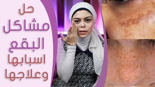 حل مشاكل البقع اسبابها وطرق علاجها