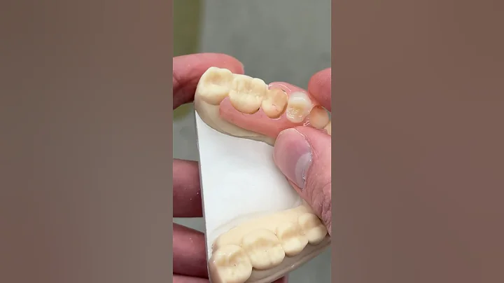 Acrylic Premolar Partial @EnvisiontecMain #envisiontec #dental #teeth #smile #lsk121shorts #shorts