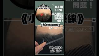 #小顏髮際線 #觀塘紋髮 #紋髮 #紋髮際線 #生髮療程 #生髮精華 #smp