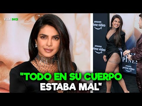 Video: 5 Celebridades Que Amamos A Pesar De Sus Defectos De Apariencia