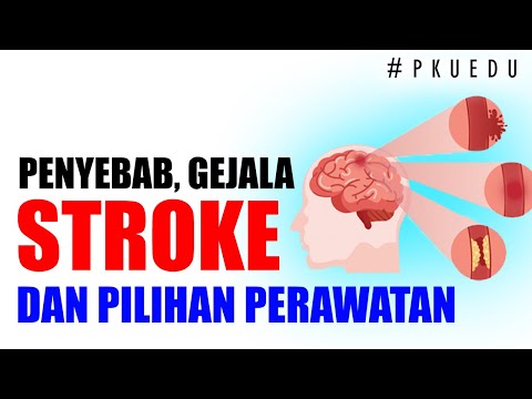 Stroke - Penyebab, Gejala dan Pilihan Perawatan | #PKUEDU