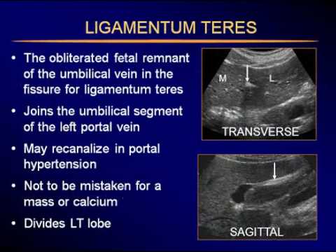 Sonography of the Liver-P2.flv - YouTube