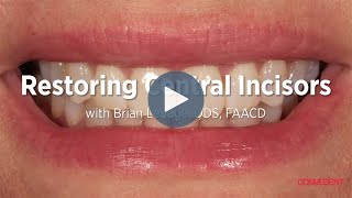 Restoring Central Incisors with Composite with Brian LeSage, DDS, FAACD