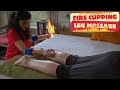 Fire leg massage its most relaxing treatment for relief stress tissues  chinese cupping massage