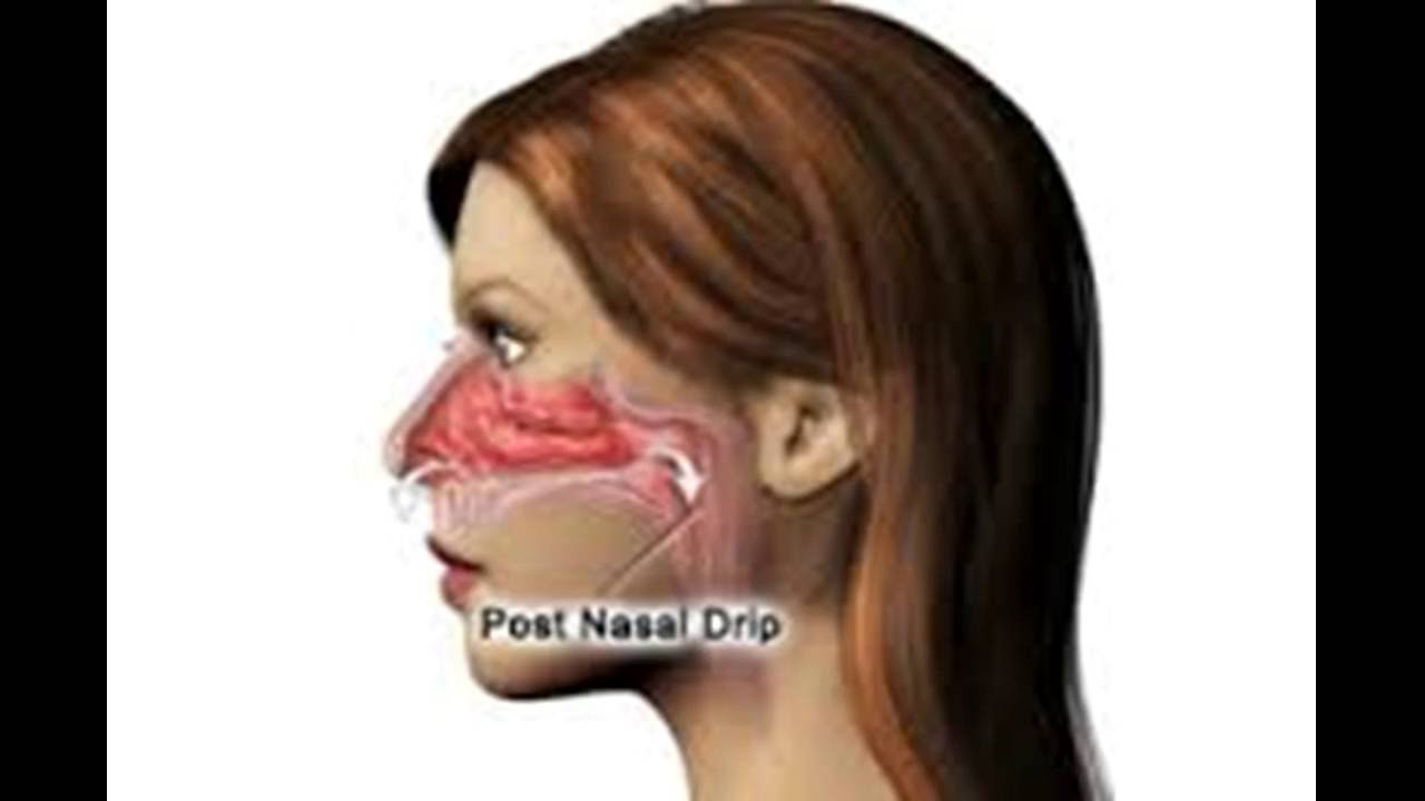 post nasal drip throw up