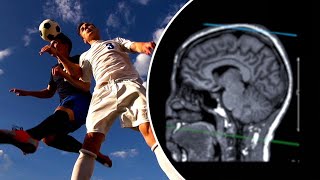 Common move used in soccer may cause brain damage similar to CTE: study