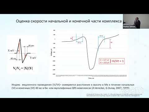 Комплексный анализ морфологических критериев в дифференциальной диагностике аритмий с широкими ...