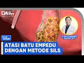 Atasi batu empedu dengan metode sils  bincang sehati