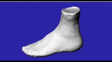 3D scanning a plaster foot cast