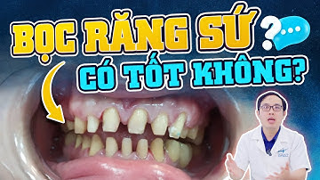 Bọc Răng Sứ có Tốt Không: 5 Sự Thật Phải Biết Trước Khi Bọc Răng Sứ - Chỉ Mất 2 Phút Để Quyết Định