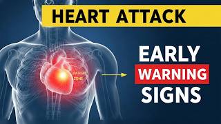 10 Silent Warning Signs of a Heart Attack That May Happen Weeks Before