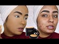 Full Coverage Powder Foundation Routine For Acne  - Review | Demo