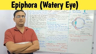 Epiphora (Watery Eye) | Causes | Symptoms | Treatment | Management @RinkeshPariyaniMedicalED