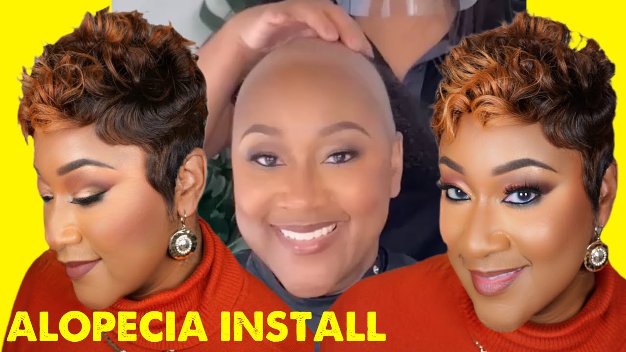 Alopecia Hairloss Application 