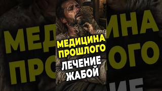 ШОКирующая Медицина Прошлого: Лечение Ангины Жабой