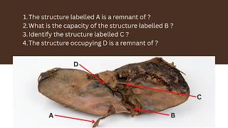 Visceral Surface of the Liver | Identification of Structures & Anatomy Practical Guide | 2nd MBBS screenshot 4