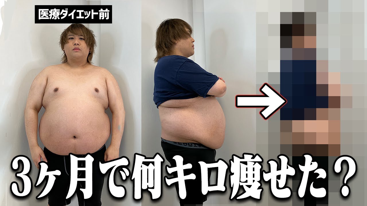 Shocking] I ended up gaining back up to 132kg, but I was able to