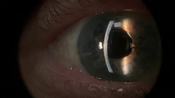 All the clinical signs you could dream of