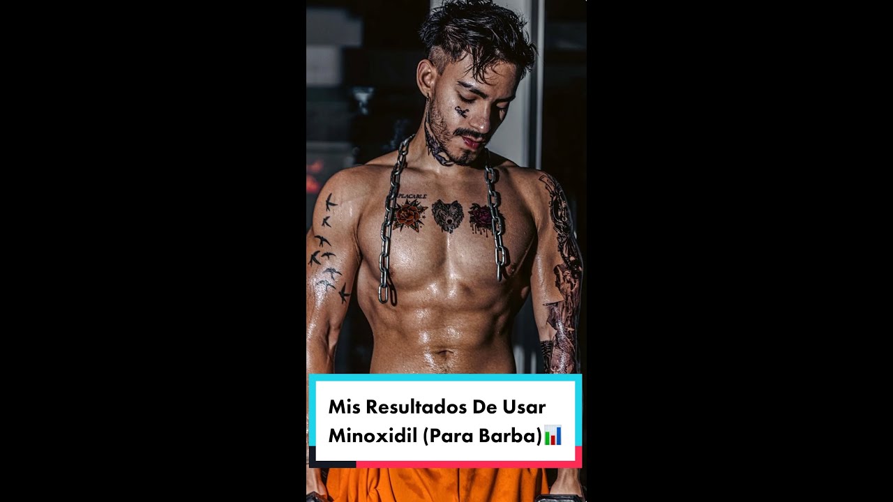 🧬Usé MINOXIDIL Por 1 Año Para Tener BARBA Y Estos Fueron Mis Resultados👉🏼📊