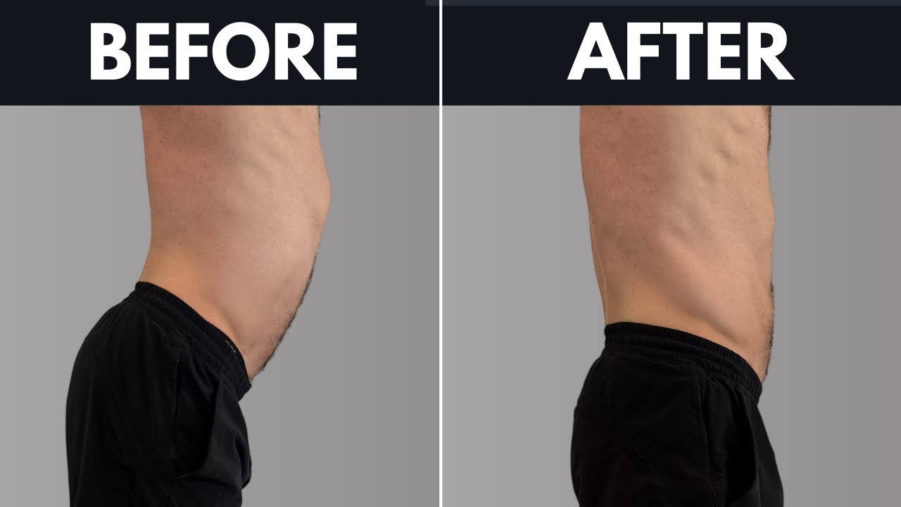 Fixing Anterior Pelvic Tilt is easy, actually.