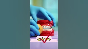 Niềng răng ăn gì Ep 21 #shorts #nhakhoa