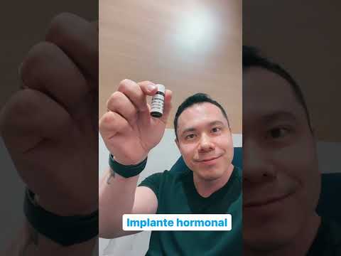 Alternativa excelente para