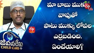 Our Sons Nose Was Swollen And Red. What To Do Jrcc 27Th January 2022 Etv Life