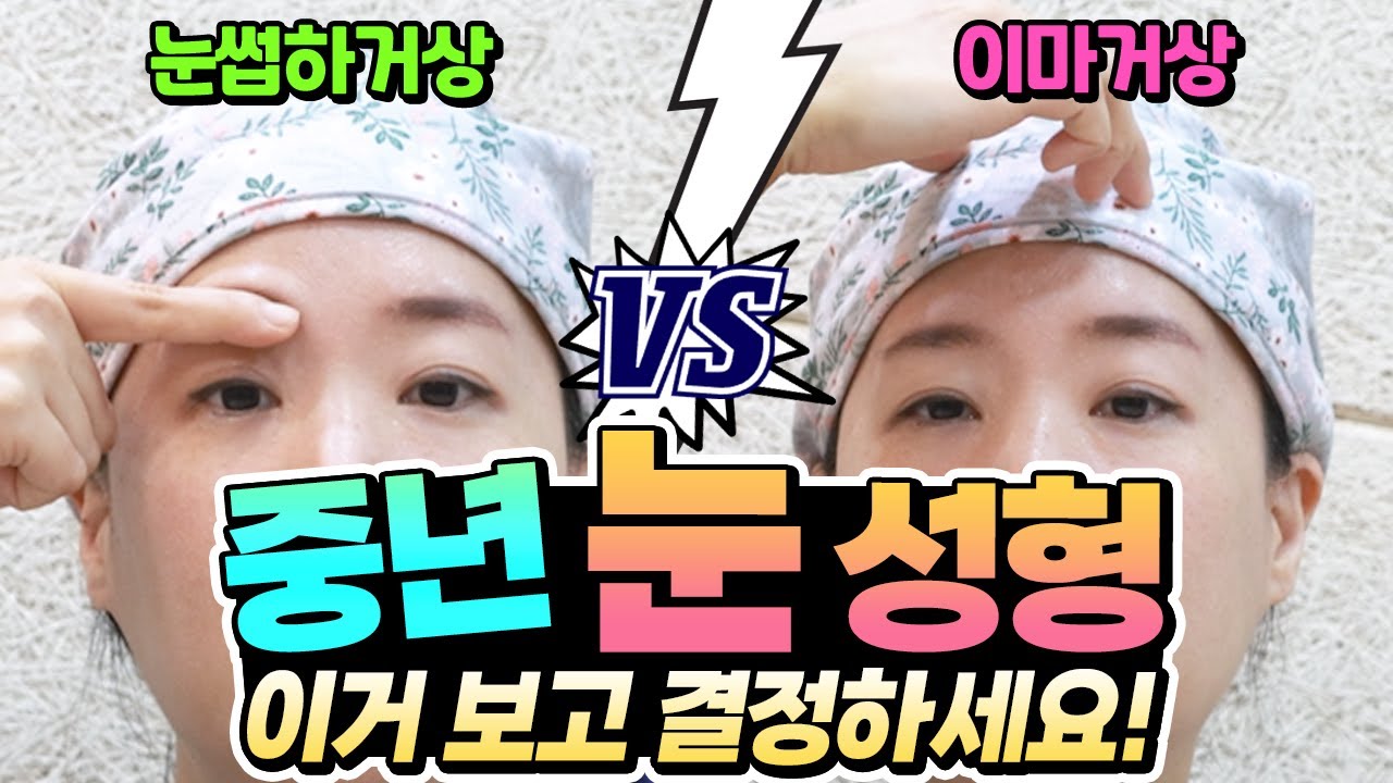 [JAYJUN Phẫu thuật thẩm mỹ và Da liễu] Tạm biệt đôi mí mắt chảy xệ! Cải thiện ấn tượng của bạn bằng cách nâng cung mày.