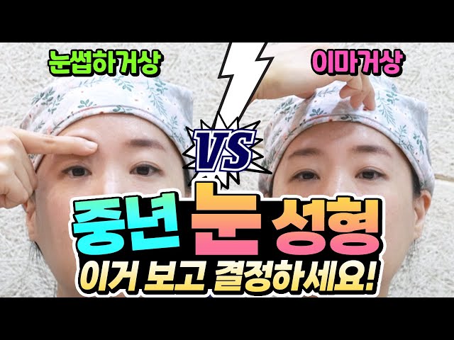 처진 눈두덩이와 이젠 작별~! 눈썹하거상으로 인상을 개선하세요.
