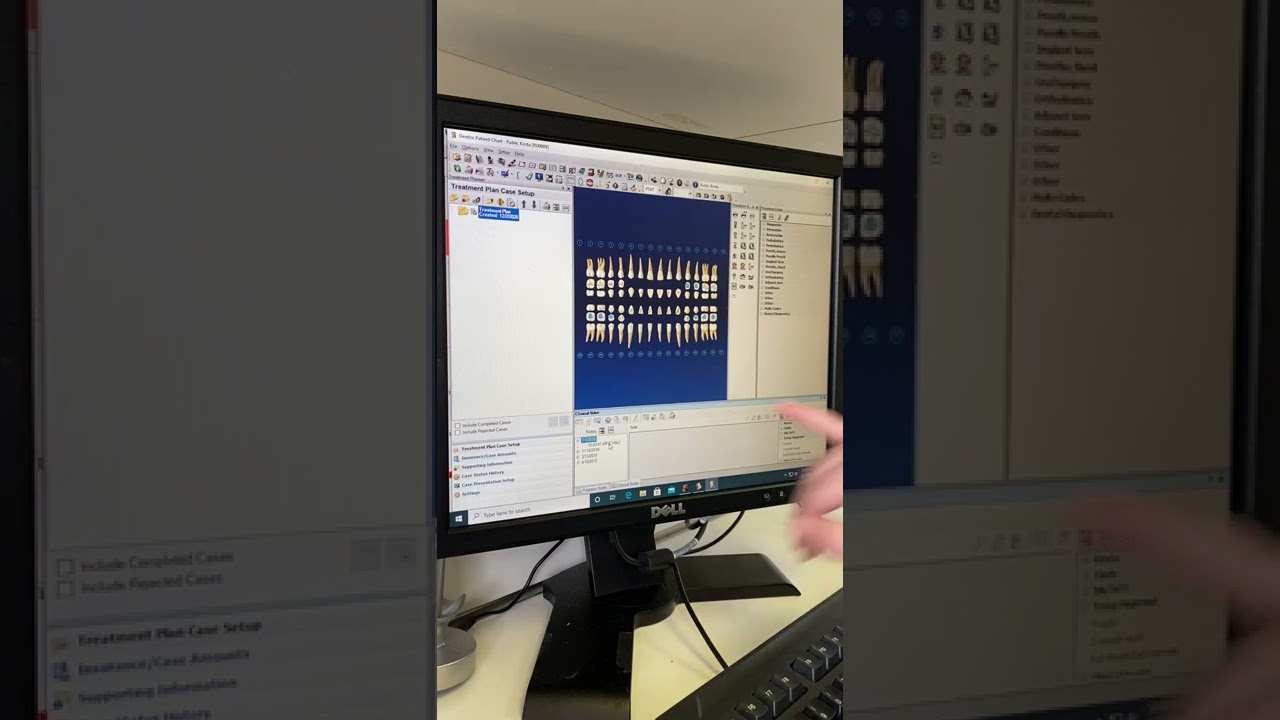 Базовое обучение Dentrix для стоматологов