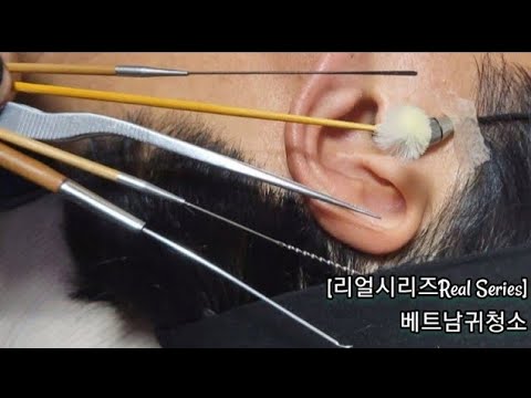 ASMR_ Real Series] 베트남귀청소_  Vietnamese ear cleaning_  ベトナム耳掃除