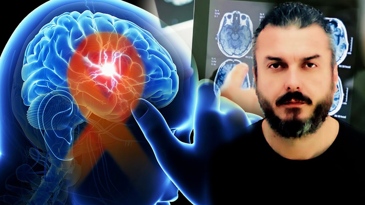 Skleroza, sëmundja invalidizuese që prek të rinjtë! Ja shenjat alarmuese…