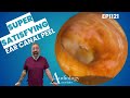 Deep Ear Wax & Skin Peel Removal! Unbelievable Extraction 😱👂 EP1121