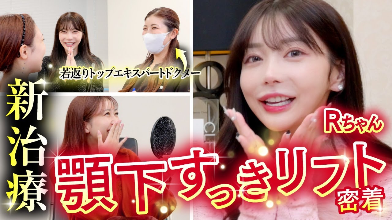 【Rちゃんコラボ治療】切らずに二重顎をなくす！手軽に小顔が叶う新治療をRちゃんファンに受けてもらいました✨【湘南美容クリニック/若返りエキスパートドクター高橋承子】