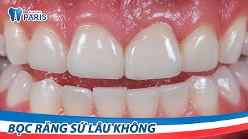 Bọc răng sứ mất bao lâu thời gian?